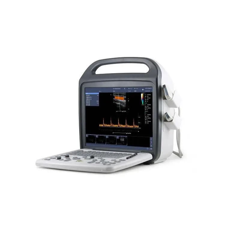 Human Use Portable Ultrasound Color Doppler Ultrasound Machine with Convex and Linear Probe for Clinic — view 1