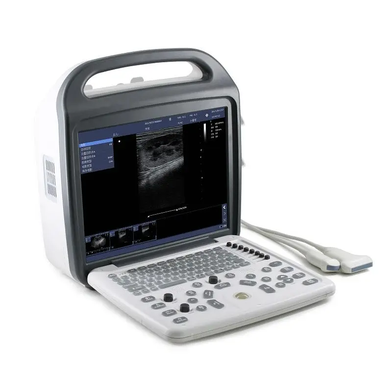 Human Use Portable Ultrasound Color Doppler Ultrasound Machine with Convex and Linear Probe for Clinic — view 2