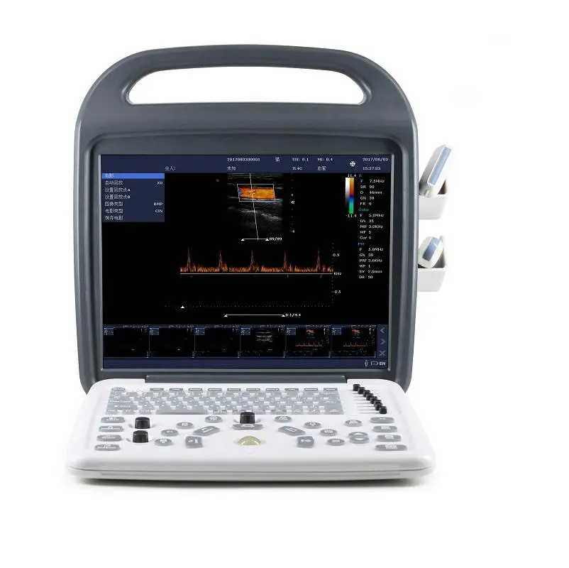 Human Use Portable Ultrasound Color Doppler Ultrasound Machine with Convex and Linear Probe for Clinic — view 4