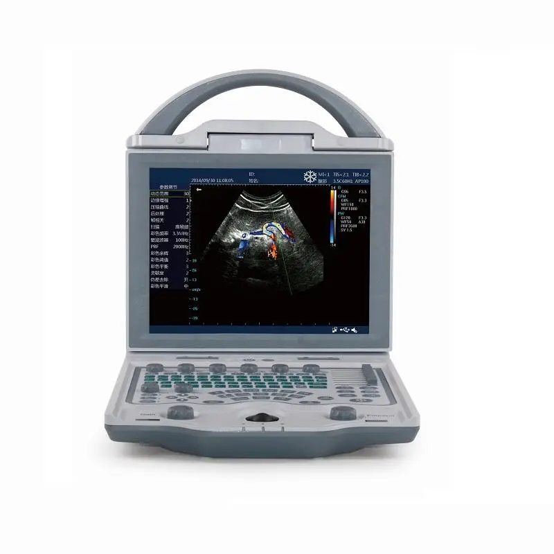 Human Color Ultrasound Portable Color Doppler Ultrasound Machine with Adjustable Screen for Clinic Use — view 1