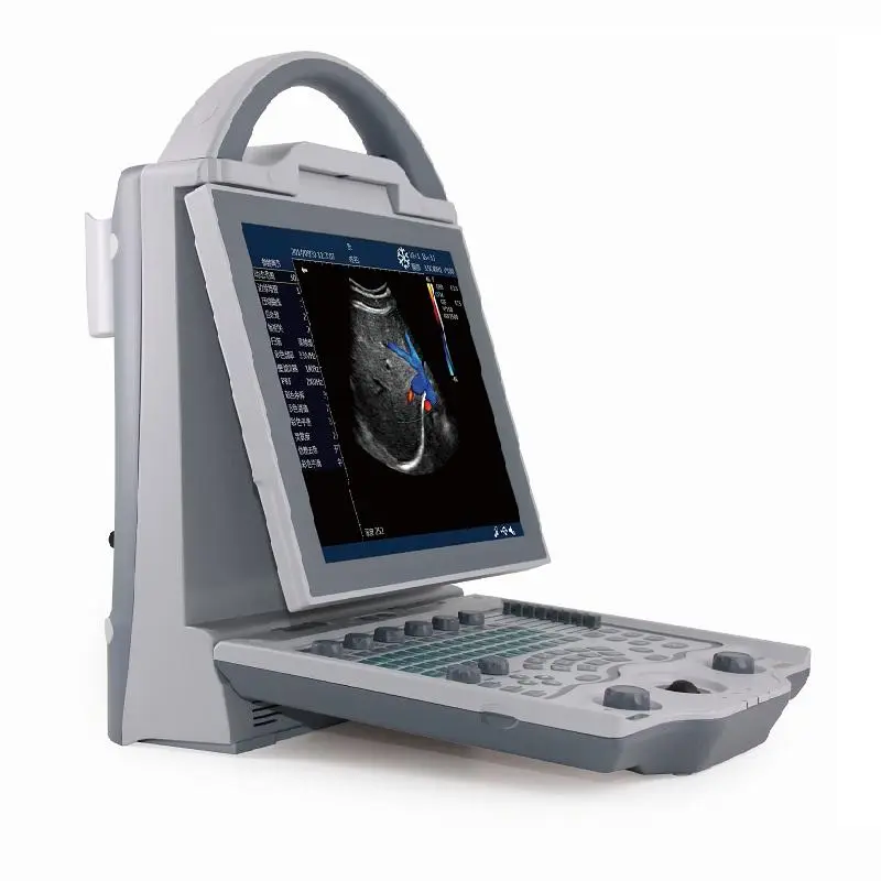 Human Color Ultrasound Portable Color Doppler Ultrasound Machine with Adjustable Screen for Clinic Use — image 2