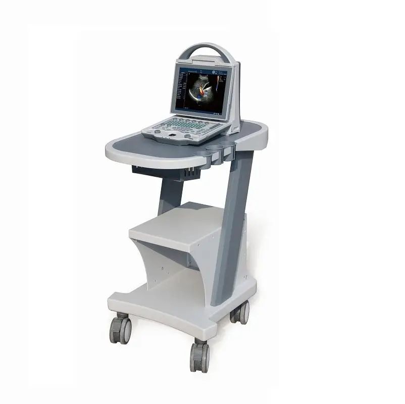 Human Color Ultrasound Portable Color Doppler Ultrasound Machine with Adjustable Screen for Clinic Use — image 3