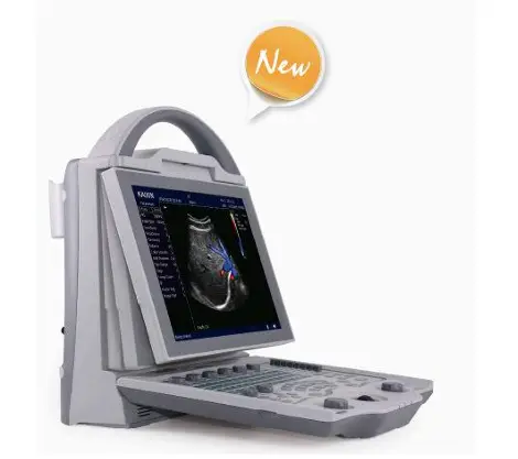 Human Color Ultrasound Portable Color Doppler Ultrasound Machine with Adjustable Screen for Clinic Use — image 6