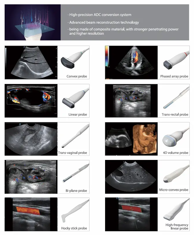 UMUS019 Model 15 Inch HD 45° Adjustable Ultrasound Machine 4D Color Doppler Ultrasound for Clinic Use — image 6