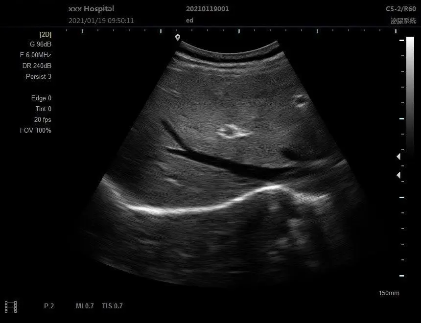 Wholesale Price 12 Inches LCD Black and White Ultrasound Portable Ultrasound Machine for Human and Vet Use — image 4