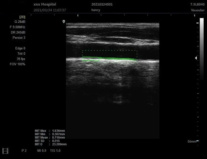 Wholesale Price 12 Inches LCD Black and White Ultrasound Portable Ultrasound Machine for Human and Vet Use — image 5