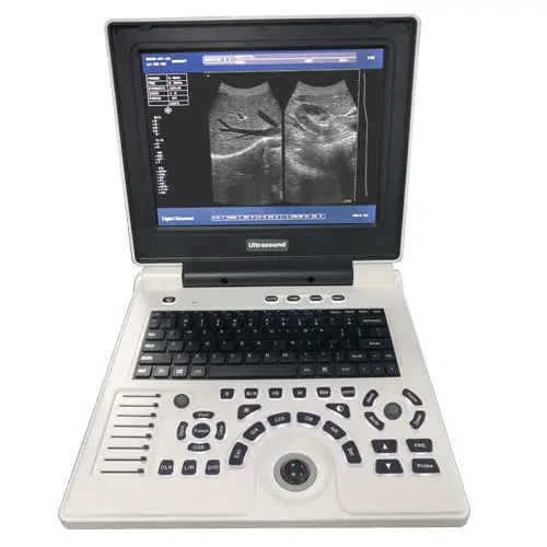 Low Price BW 12'' Laptop Ultrasound Machine Portable Ultrasound Scanner for Wholesale and Use — view 1