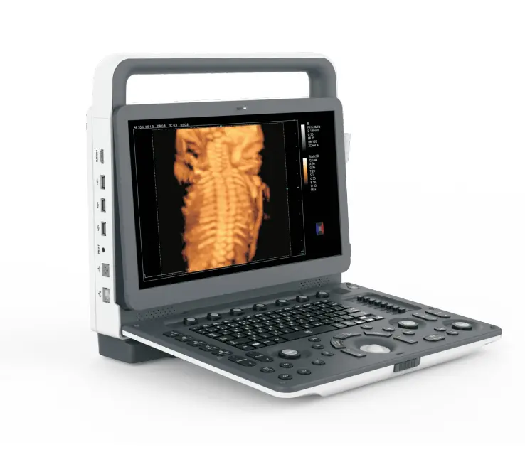 Portable Color Doppler Ultrasound UMUS081 3D/4D/5D Imaging for Abdomen/Cardiology — view 1