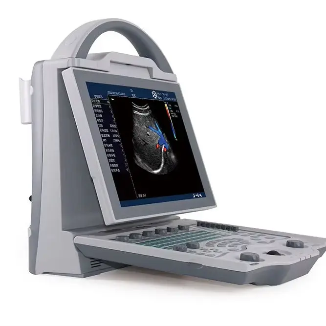 UMY UML5 Portable Electric Doppler Ultrasound Scanner for Pigs and Sheep Veterinarian Medical Diagnostic Class II Color — view 1