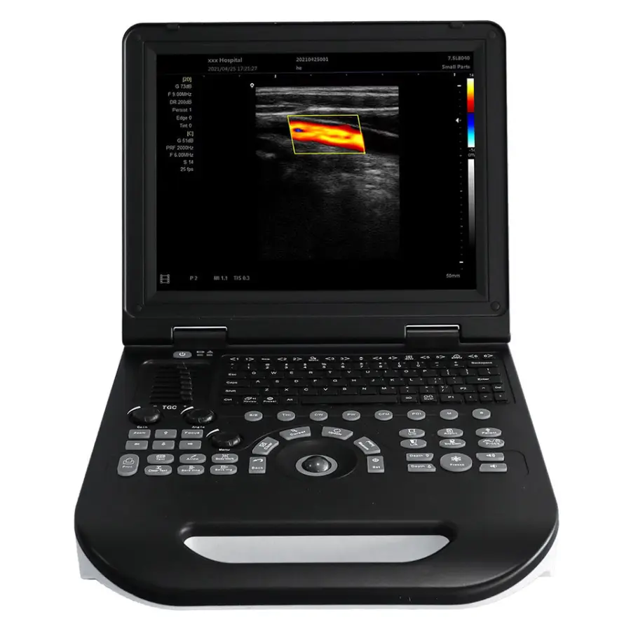 UMY L30i Portable Veterinary Dog & Small Animal Ultrasound Scanner Class II USB Rechargeable CE Certified 2-Year Warranty — image 3