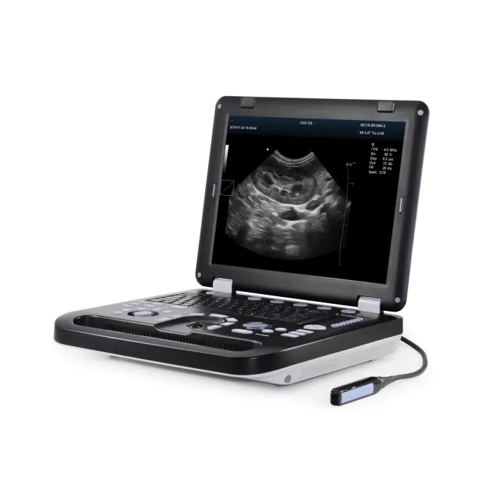 Full Digital Veterinary Portable Ultrasound Machine Color Doppler Ultrasonic Diagnostic Instrument Electric Power — image 7
