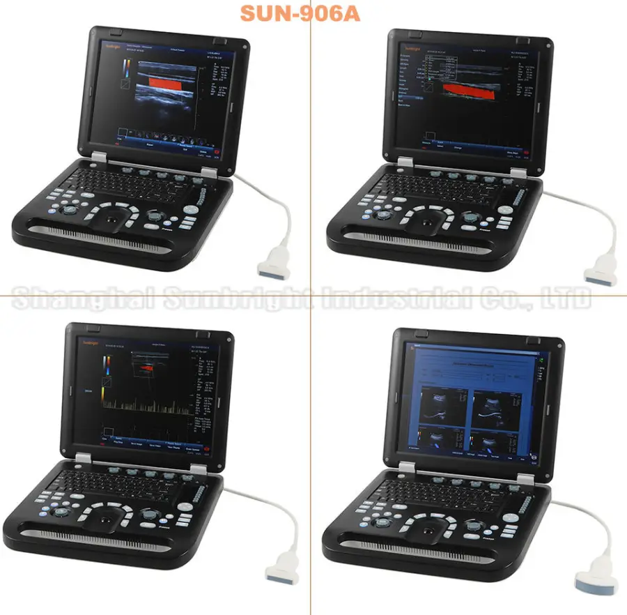 Portable 3d Ultrasound for Medical Diagnostic Imaging Center Using Veterinary Human Color Ultrasound for Gynecology — image 3