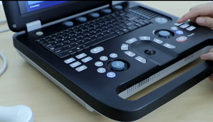 Portable 3d Ultrasound for Medical Diagnostic Imaging Center Using Veterinary Human Color Ultrasound for Gynecology — image 5