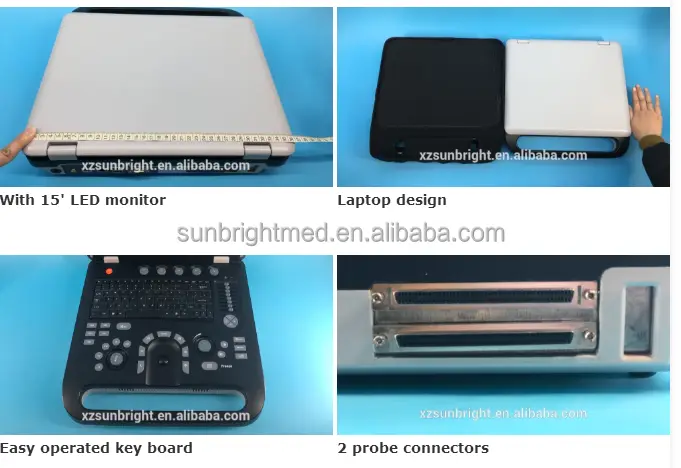 Portable 3d Ultrasound for Medical Diagnostic Imaging Center Using Veterinary Human Color Ultrasound for Gynecology — image 7