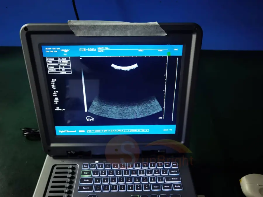 SUN-806A High Cost-effective and High Grade Laptop BW Ultrasound Scan Equipment for Vet — image 7