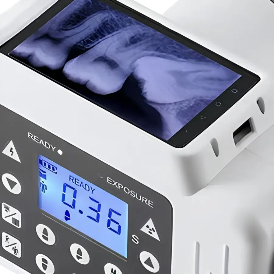 Portable Digital Dental X-ray Machine 2 in 1 Sensor Imaging Unit Battery and AC Powered for Clinic Use — image 4