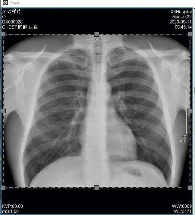 Careray 17"17" Medical Dr X Ray System Digital Wireless X Ray Flat Panel Detector De Rayos X MSLCV17 Equipment — image 5