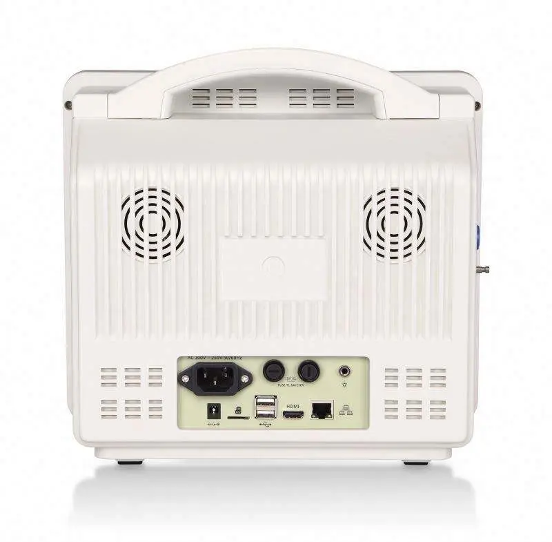 Competitive Price 12 Inch Portable Multi-parameter Monitor ECG with Human and Veterinary Versions for Hospital and Clinic — image 6