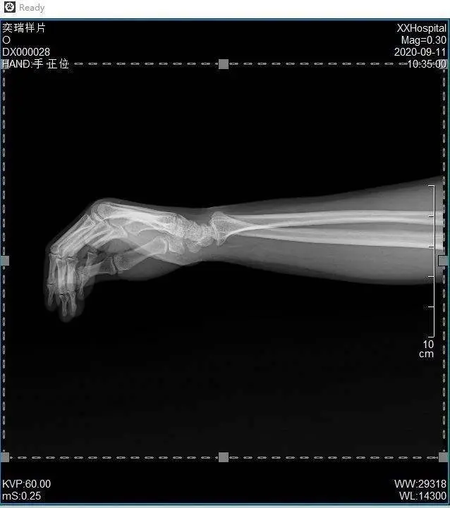 Careray 17"17" Medical Dr X Ray System Digital Wireless X Ray Flat Panel Detector De Rayos X MSLCV17 Equipment — image 6