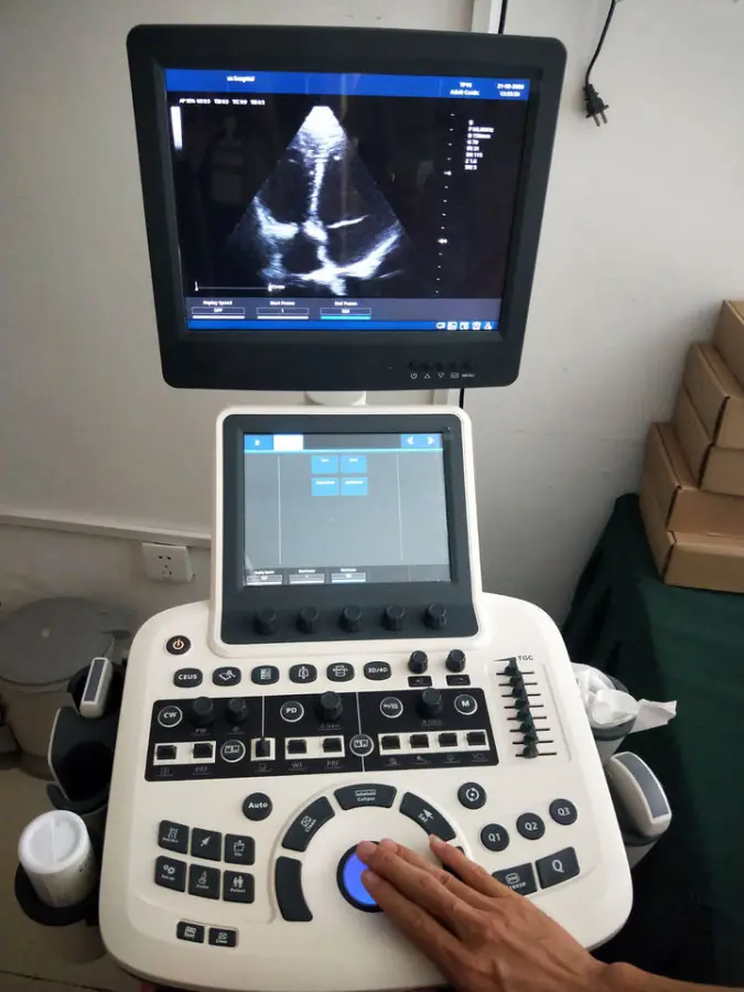 Abdomen Gynecology Obstetrics 4D Color Doppler Ultrasound Trolley Machine for Human & Animal Use — image 3