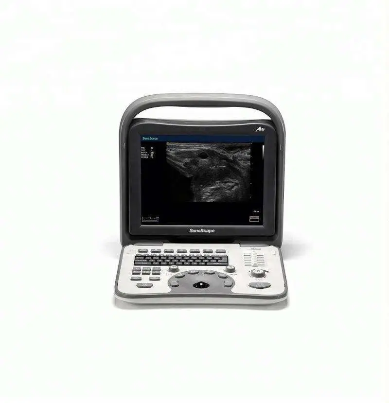Exceptional A6 Sonoscape Ultrasound Transducer / High Resolution Portable A6 — view 1