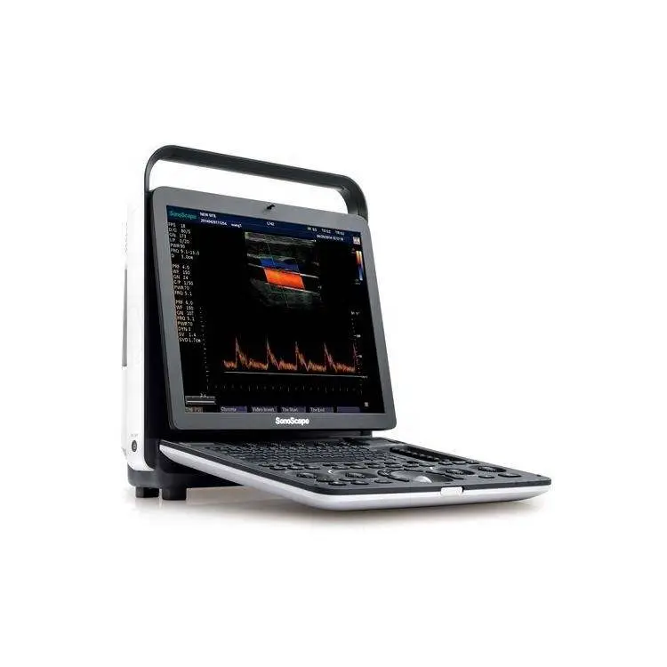 S9 Portable Color Doppler Ultrasound Dual Screen 10 Imaging Modes 500GB ECG — image 3