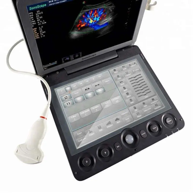 S9 Portable Color Doppler Ultrasound Dual Screen 10 Imaging Modes 500GB ECG — image 5
