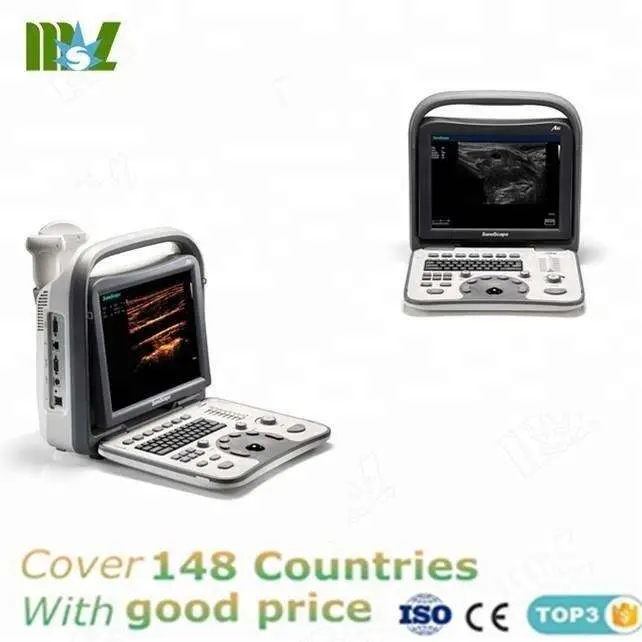 Exceptional A6 Sonoscape Ultrasound Transducer / High Resolution Portable A6 — image 4