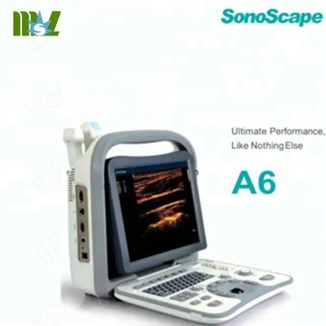 Exceptional A6 Sonoscape Ultrasound Transducer / High Resolution Portable A6 — image 5