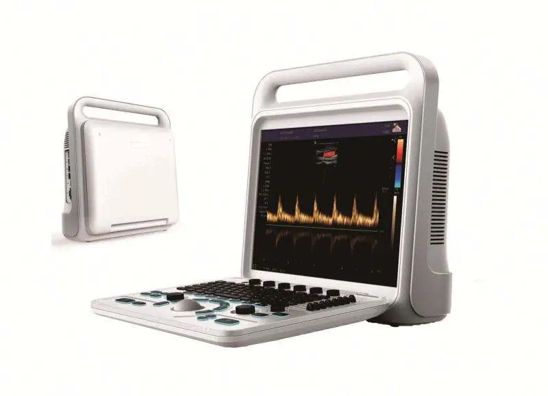Trolley Medical Color Doppler 3D 4D Hospital Ultrasound Machine — image 2