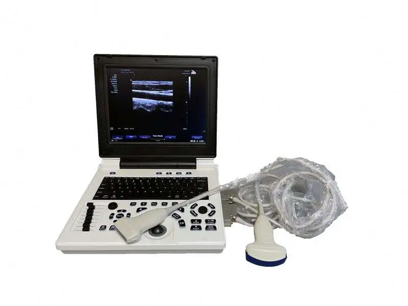 Best Price Medical Color Doppler Hospital Ultrasound Machine — image 4
