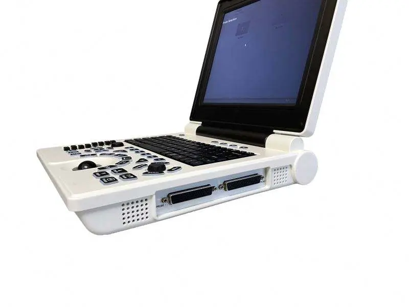 Best Price Medical Color Doppler Hospital Ultrasound Machine — image 5