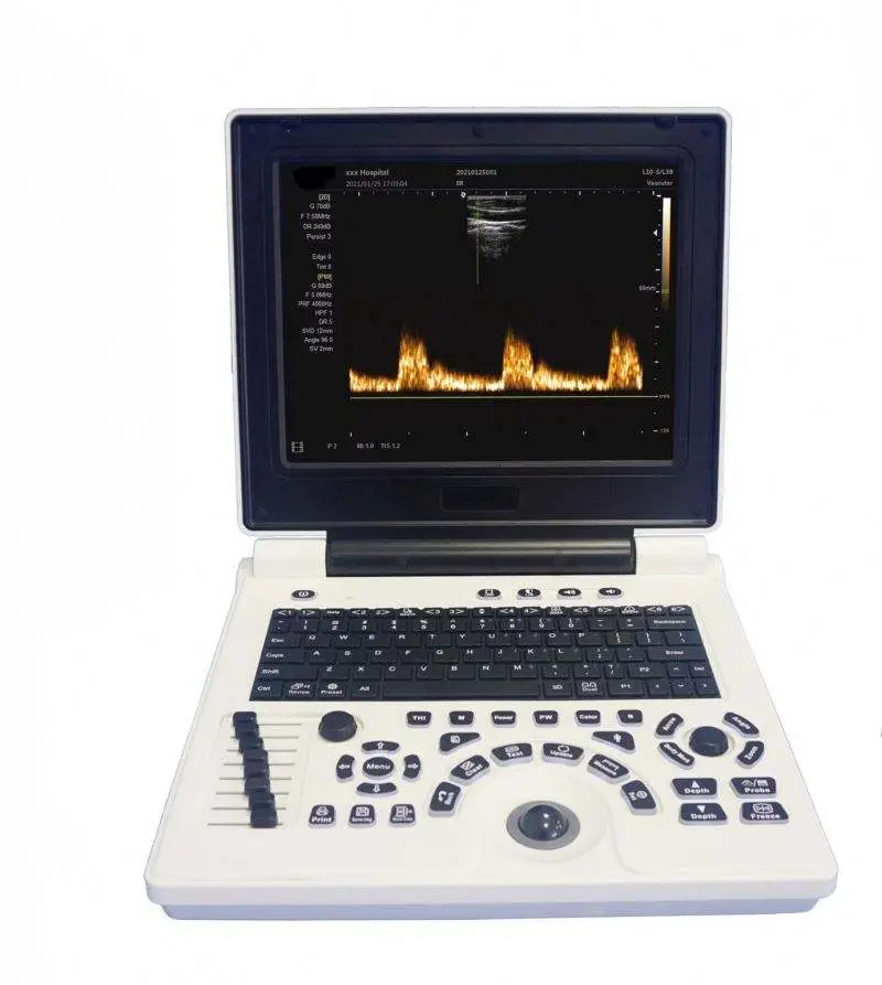Best Price Medical Color Doppler Hospital Ultrasound Machine — image 6
