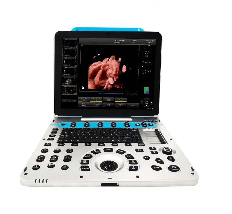 12.1 Inch 4D 3D Diagnostic Ultrasound Machine Color Doppler Ultrasound Machine — view 1