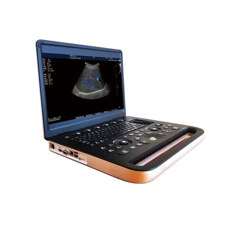 Best Price Portable Human Vet Medical Ultrasound Machine Color Doppler — view 1