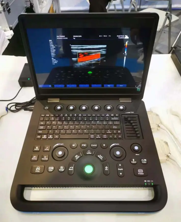 Best Price Portable Human Vet Medical Ultrasound Machine Color Doppler — image 2
