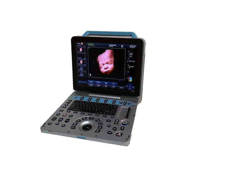 12.1 Inch 4D 3D Diagnostic Ultrasound Machine Color Doppler Ultrasound Machine — image 4