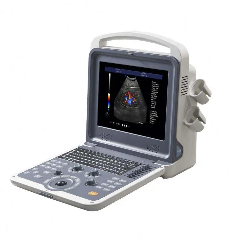 Medical 4D Human Vet Portable Color Doppler Ultrasound System Hospital Ultrasound Scanner — view 1