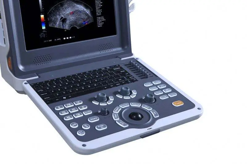 Medical 4D Human Vet Portable Color Doppler Ultrasound System Hospital Ultrasound Scanner — image 2