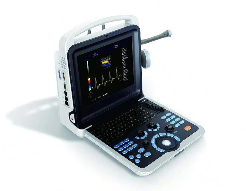 Medical 4D Human Vet Portable Color Doppler Ultrasound System Hospital Ultrasound Scanner — image 3