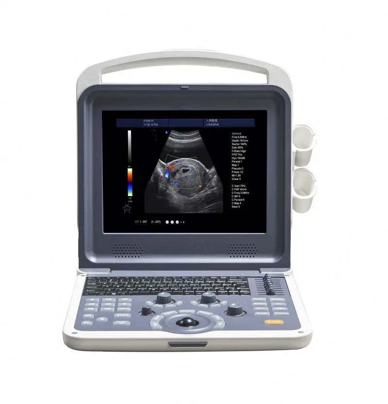 Medical 4D Human Vet Portable Color Doppler Ultrasound System Hospital Ultrasound Scanner — image 4