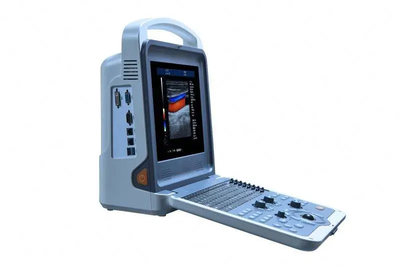 Medical 4D Human Vet Portable Color Doppler Ultrasound System Hospital Ultrasound Scanner — image 5