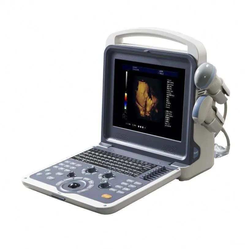 Medical 4D Human Vet Portable Color Doppler Ultrasound System Hospital Ultrasound Scanner — image 6