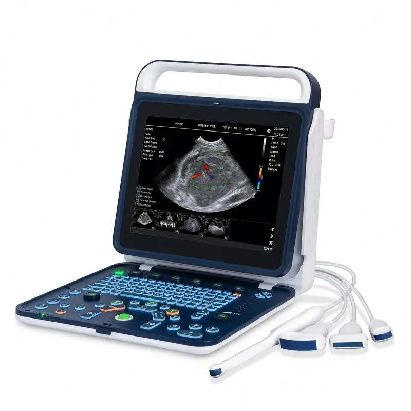 Medical Ultrasound Instruments Portable Color Doppler Ultrasound Machine — view 1