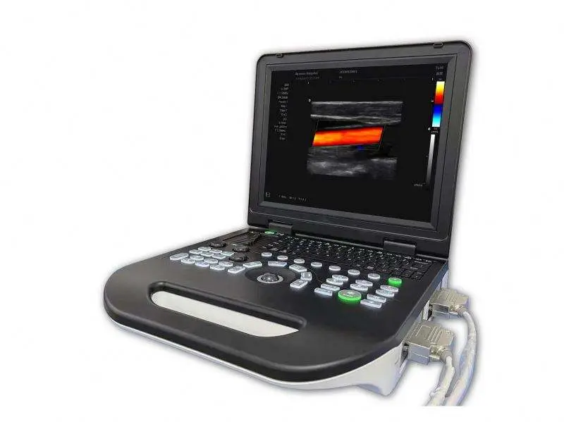 Portable Human Vet 2d 3d 4d Medical Ultrasound Machine Color Doppler — image 2