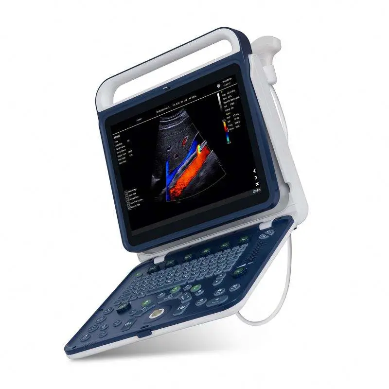 Medical Ultrasound Instruments Portable Color Doppler Ultrasound Machine — image 2