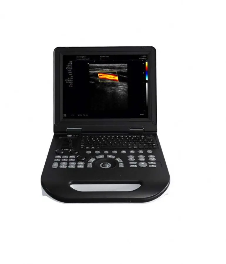 Portable Human Vet 2d 3d 4d Medical Ultrasound Machine Color Doppler — image 4