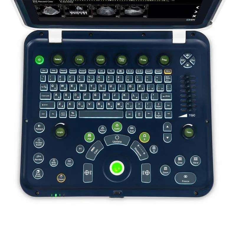 Medical Ultrasound Instruments Portable Color Doppler Ultrasound Machine — image 4