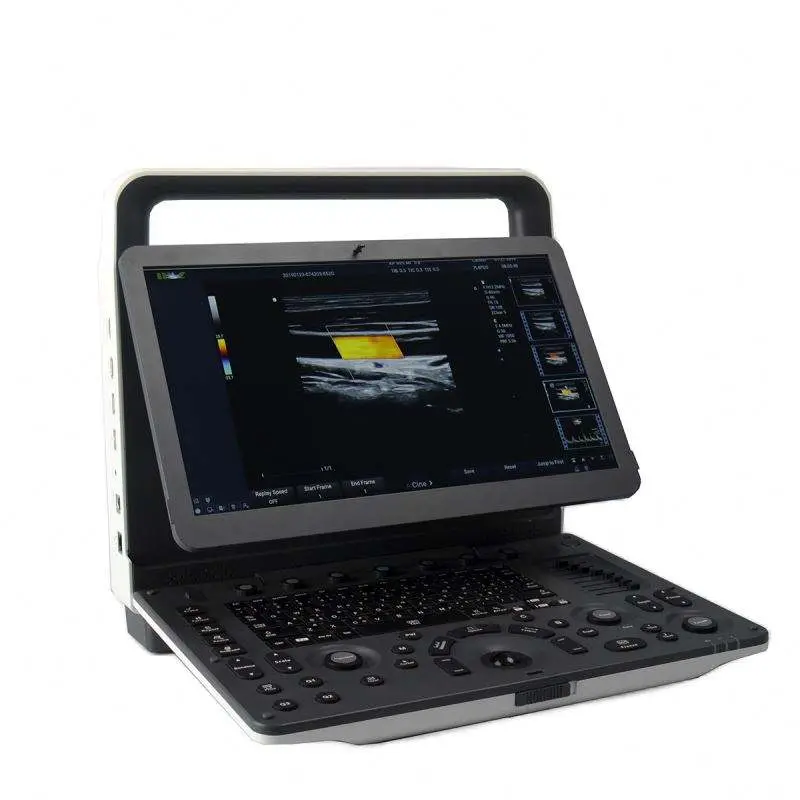 Human High Resolution Medical 4D 5D Color Doppler Portable 5D Ultrasound Machine — view 1