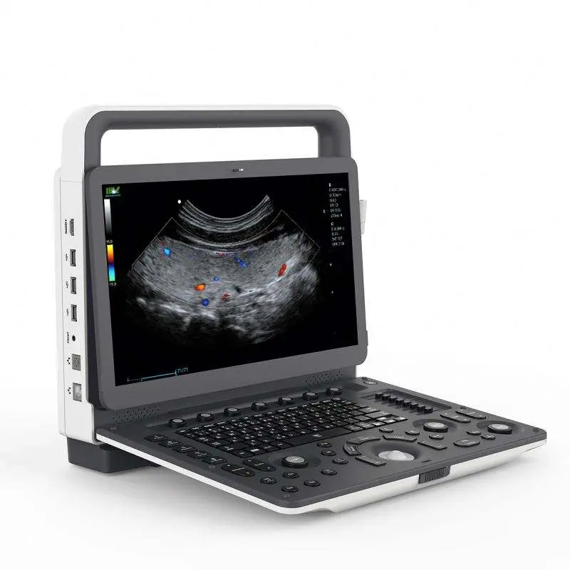 Human High Resolution Medical 4D 5D Color Doppler Portable 5D Ultrasound Machine — image 3